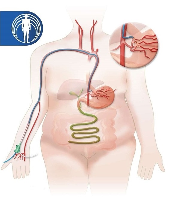 Estudios cardiologicos